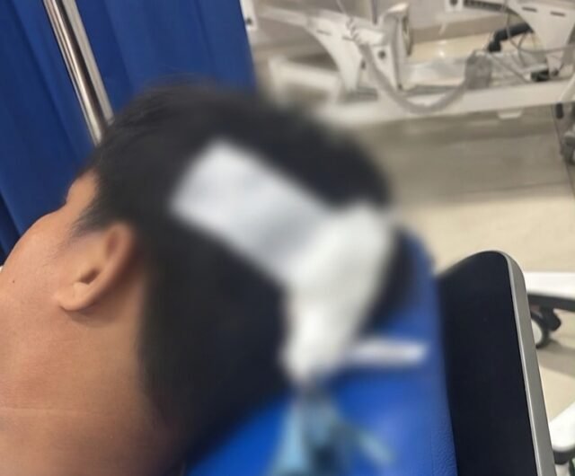 Seorang remaja berusia 16 tahun menjadi korban dan mengalami luka pada bagian kepala setelah terkena busur panah di kawasan Jalan Sultan Alauddin, Makassar pada Minggu (28/8/2026) dini hari.