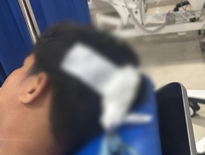 Seorang remaja berusia 16 tahun menjadi korban dan mengalami luka pada bagian kepala setelah terkena busur panah di kawasan Jalan Sultan Alauddin, Makassar pada Minggu (28/8/2026) dini hari.