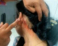 Korban dugaan penganiayaan, FTS, saat menjalani perawatan setelah mengalami sejumlah luka akibat insiden di kawasan Jalan Kancil, Kecamatan Mamajang, Makassar.
