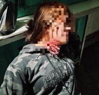 Korban pembusuran, AM (22), mengalami luka di bagian atas dada setelah terkena anak panah di Jalan Haji Kalla, kawasan Panaikang, Makassar, Rabu (14/10/2026).